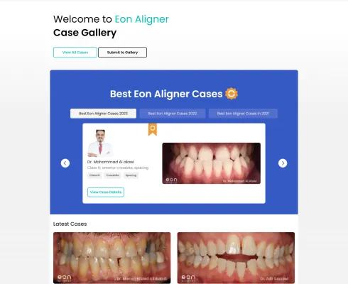 EON Aligner 